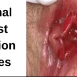 Discover the Most Causes of Vaginal Discharges 2022