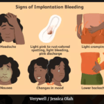 Why Implantation Bleeding Problem Increasing 2022?